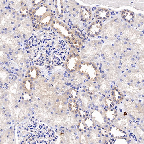 VPS35 Recombinant Rabbit mAb (S-997-2)