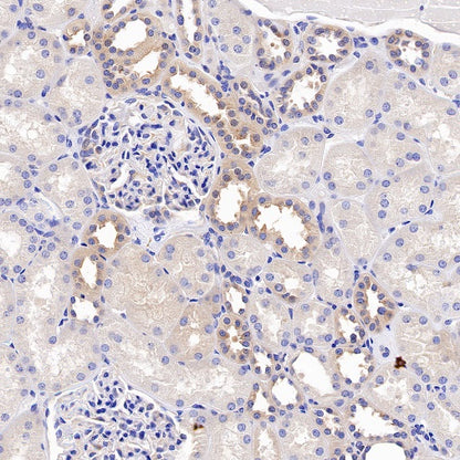 VPS35 Recombinant Rabbit mAb (S-997-2)
