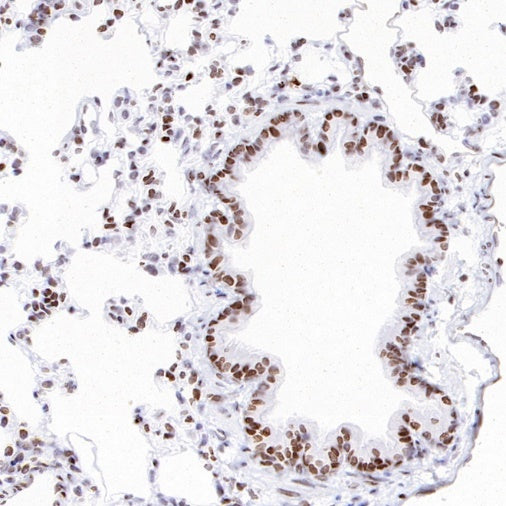 Histone H3 (acetyl K23) Recombinant Rabbit mAb (S-3321-202)