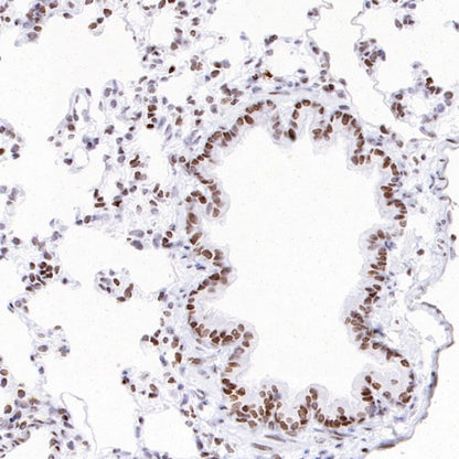 Histone H3 (acetyl K23) Recombinant Rabbit mAb (S-3321-202)