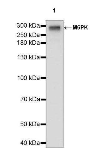 M6PR Recombinant Rabbit mAb (S-1480-21)