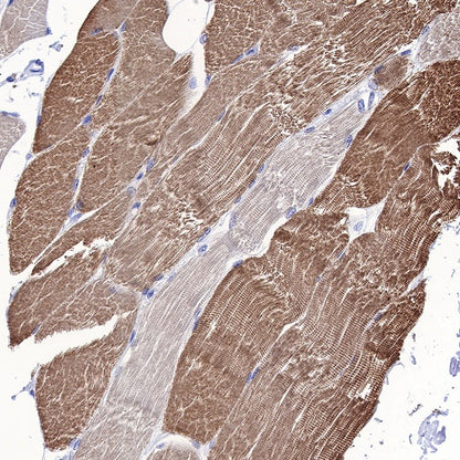 Myosin light chain 3 Recombinant Rabbit mAb (S-664-75)