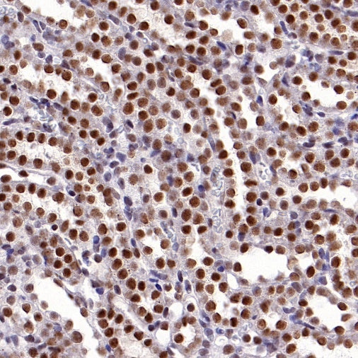 O-Linked N-Acetylglucosamine Rabbit mAb (S-R256)