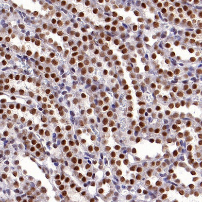 O-Linked N-Acetylglucosamine Rabbit mAb (S-R256)