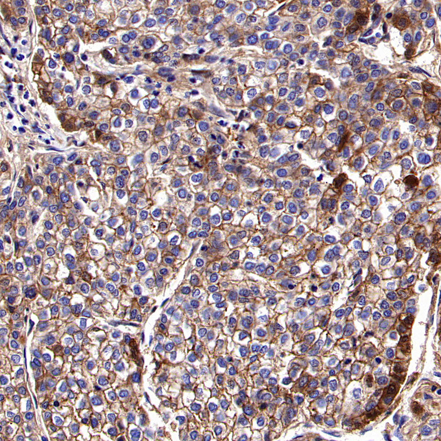 PTK7 Recombinant Rabbit mAb ,PBS Only(SDT-2432-156)