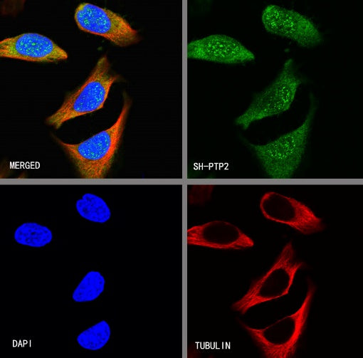 SH-PTP2 Recombinant Rabbit mAb (S-1318-2)