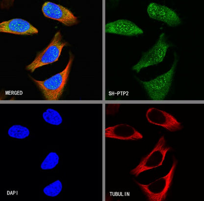SH-PTP2 Recombinant Rabbit mAb (S-1318-2)