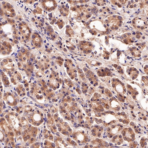 PI3 Kinase p85 Recombinant Rabbit mAb (SDT-R108)