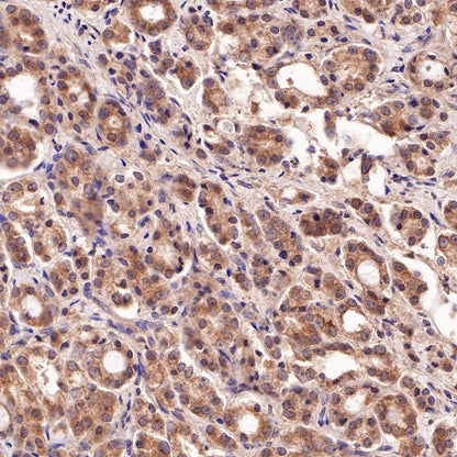 PI3 Kinase p85 Recombinant Rabbit mAb (SDT-R108)