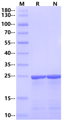 MSP1D1 His Tag Protein (Nanodisc), Human