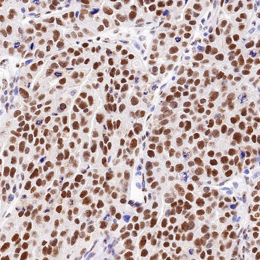 Cyclin K Recombinant Rabbit mAb (S-1586-18)