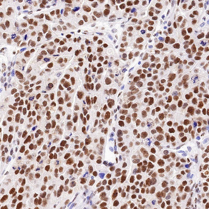Cyclin K Recombinant Rabbit mAb (S-1586-18)