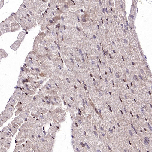 RIPK1 Rabbit Polyclonal Antibody