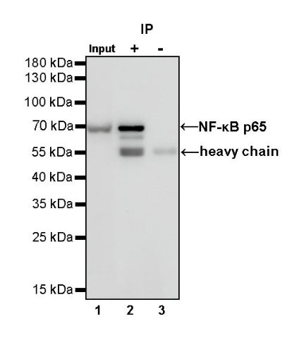 NF-κB p65 Recombinant Rabbit mAb (S-475-56)