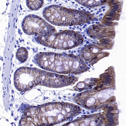 TROP1/EPCAM Recombinant Rabbit mAb (S-1379-5)