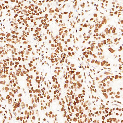 pan Brd4 Recombinant Rabbit mAb (S-6208)