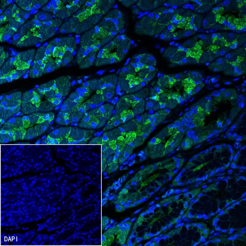 Pepsinogen I Recombinant Rabbit mAb (S-723-104)