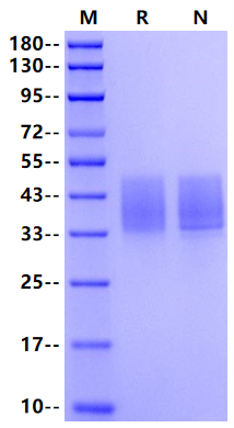 IL-10 R beta  His Tag Protein, Human