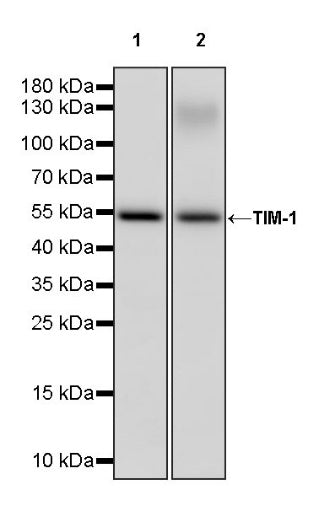TIM-1 Recombinant Rabbit mAb (S-1555-147)
