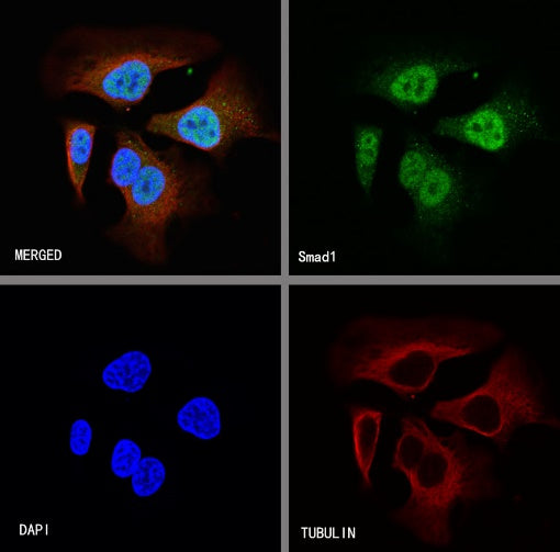 SMAD1 Rabbit Polyclonal antibody