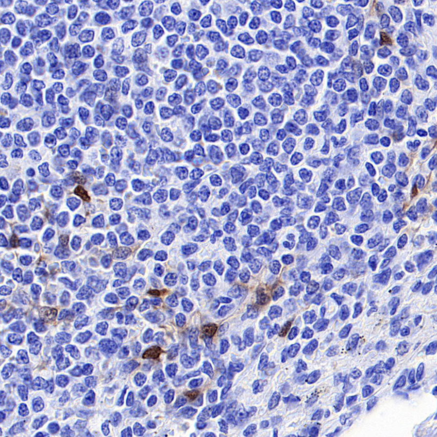 Phospho-p44/42 MAPK (Erk1/2) (Thr202/Tyr204) Recombinant Rabbit mAb (S-5119)