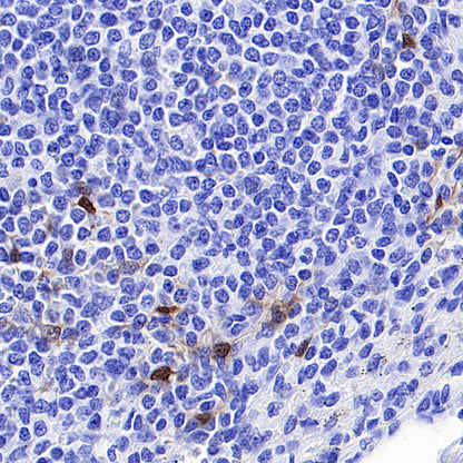 Phospho-p44/42 MAPK (Erk1/2) (Thr202/Tyr204) Recombinant Rabbit mAb (S-5119)