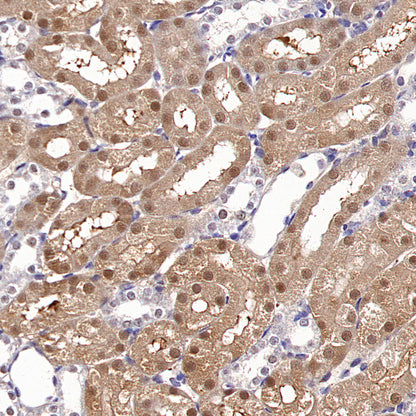 Tug Recombinant Rabbit mAb (S-4377-21)