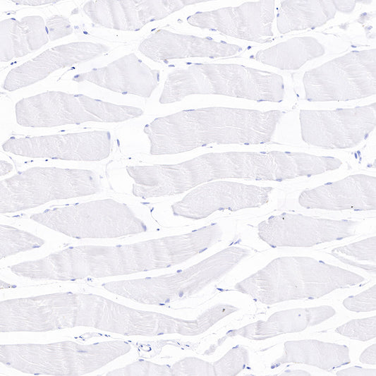 Cadherin 17 Recombinant Rabbit mAb,PBS Only (SDT-R151)