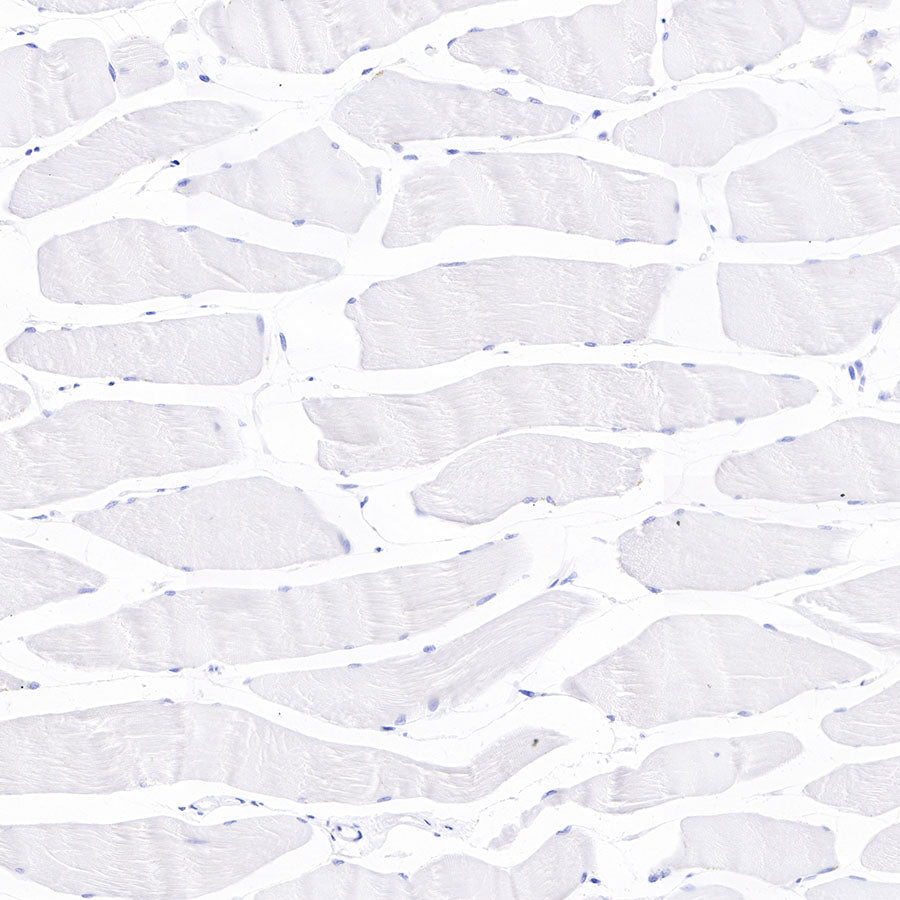 Cadherin 17 Recombinant Rabbit mAb,PBS Only (SDT-R151)