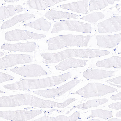 Cadherin 17 Recombinant Rabbit mAb,PBS Only (SDT-R151)