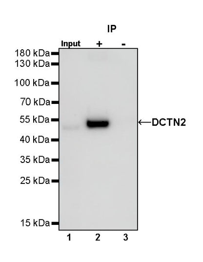 DCTN2 Recombinant Rabbit mAb (S-1082-7)