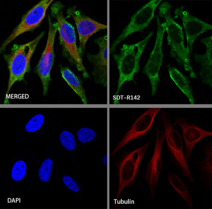 alpha smooth muscle Actin Recombinant Mouse mAb (SDT-R142)