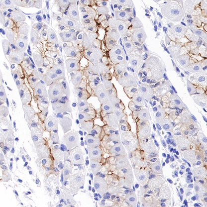 Aquaporin 5/AQP5 Recombinant Rabbit mAb (S-1622-5)