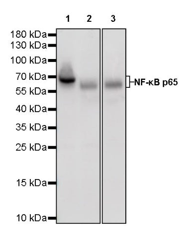 NF-κB p65 Recombinant Rabbit mAb (S-475-56)