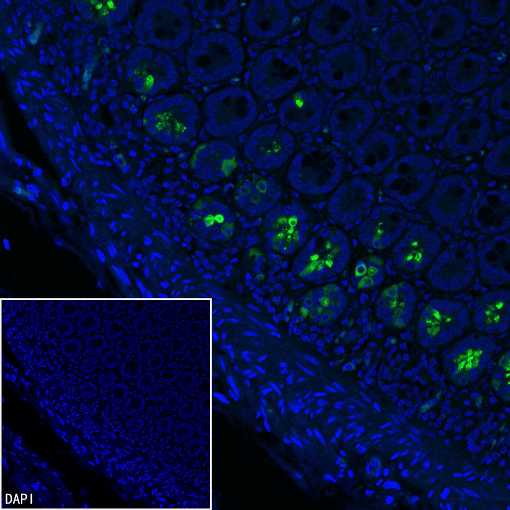 NOD2 Recombinant Rabbit mAb (SDT-3245-112)