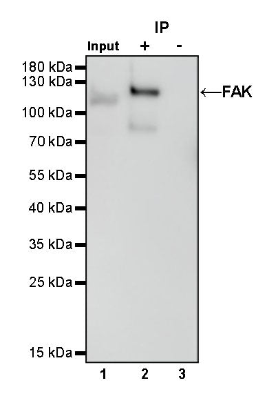 FAK Recombinant Rabbit mAb (S-1180-10)