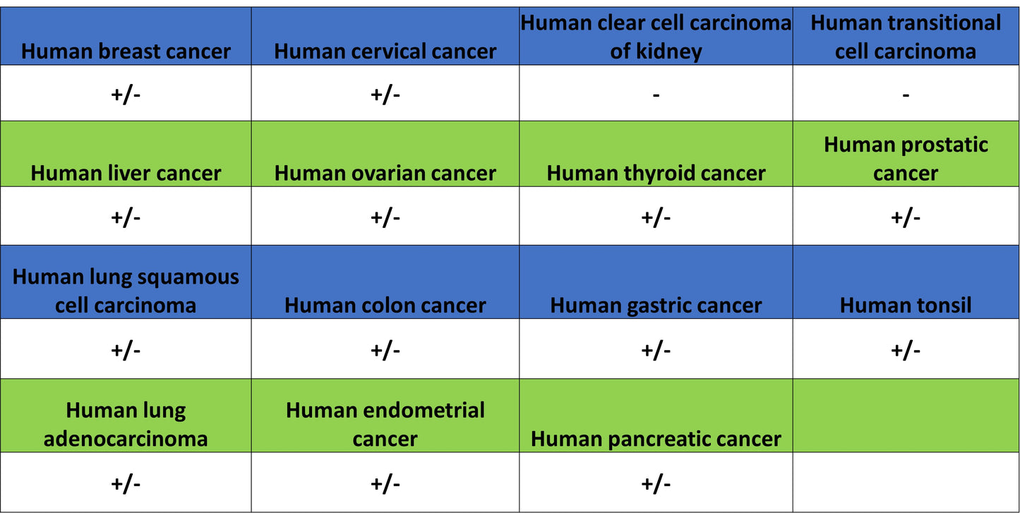 TRIM21 Mouse mAb (S-M0045)