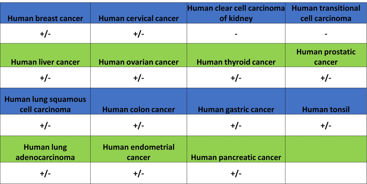 TRIM21 Mouse mAb (S-M0045)