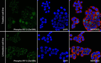 Phospho-IRF3 (Ser386) Recombinant Rabbit mAb (S-3498)