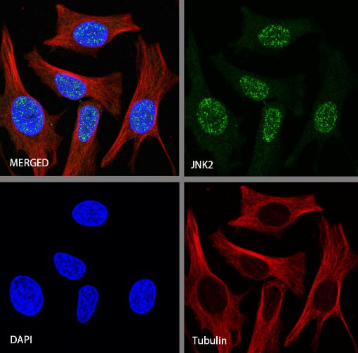 JNK2 Recombinant Rabbit mAb (S-1021-46)