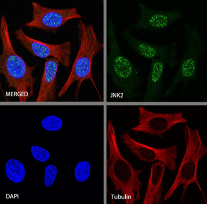 JNK2 Recombinant Rabbit mAb (S-1021-46)