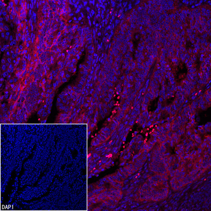 EpCAM Recombinant Rabbit mAb (PE Conjugate) (S-078-128)