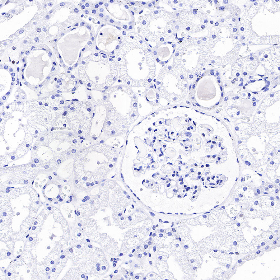 Androgen Receptor Recombinant Rabbit mAb (SDT-R157)