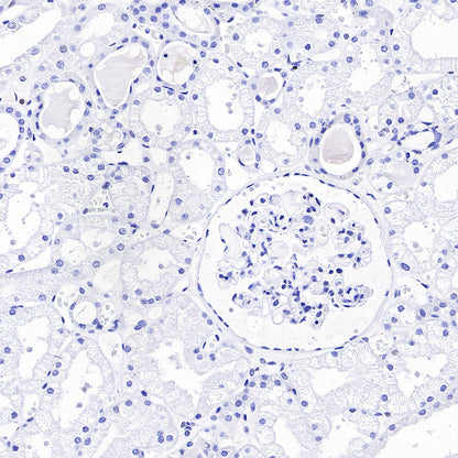 Androgen Receptor Recombinant Rabbit mAb (SDT-R157)
