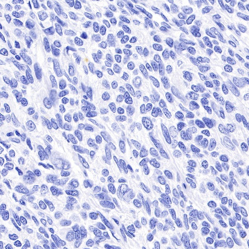Myelin Basic Protein Recombinant Rabbit mAb (S-582-79)