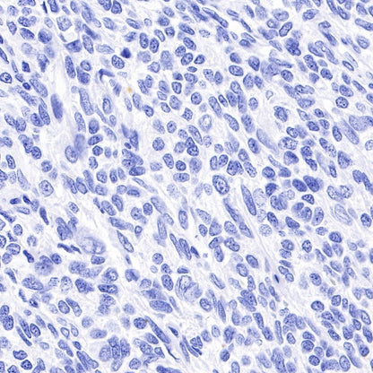 Myelin Basic Protein Recombinant Rabbit mAb (S-582-79)