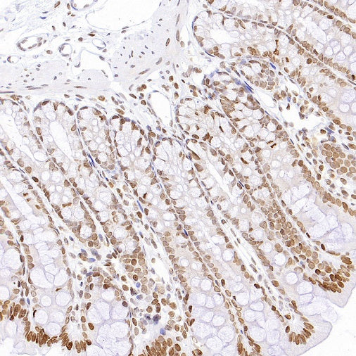 Histone H3 (acetyl K4) Recombinant Rabbit mAb (S-848-137)
