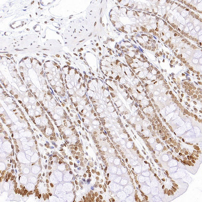 Histone H3 (acetyl K4) Recombinant Rabbit mAb (S-848-137)
