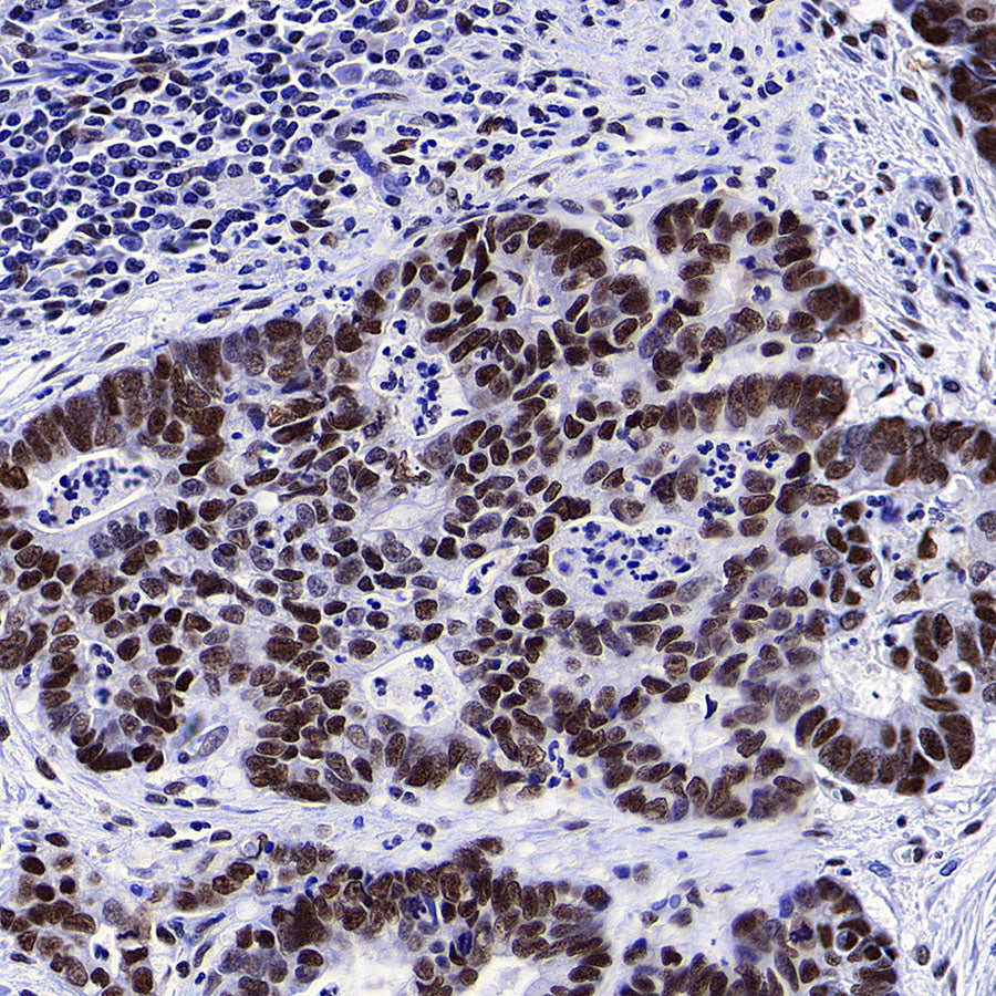 CoREST Recombinant Rabbit mAb (S-4401-8)