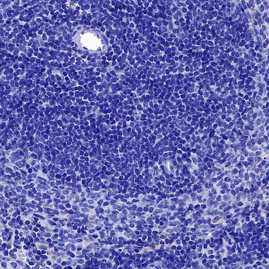 VGLUT2 Recombinant Rabbit mAb (S-4399-14)